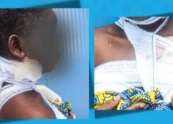 Concerned Neighbors Alert NAPTIP as Madam Throws Hot Water on Teenage House Help